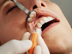 Les 7 meilleurs conseils pour prendre soin de vos dents du Dr Pierre Boucher, dentiste à Paris